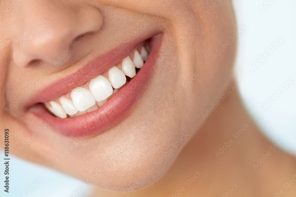 How to Whiten Your Teeth at Home: A Personal Guide to Radiant Smiles